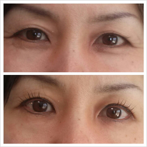 まつ毛パーマ・Before_After4_正面