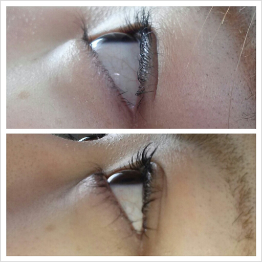 まつ毛パーマ・Before_After1_横